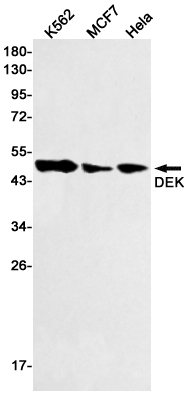 DEK Rabbit mAb