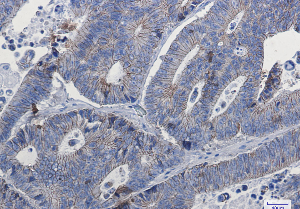 delta 1 Catenin Rabbit mAb