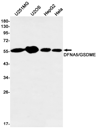 GSDME Rabbit mAb