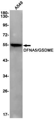 GSDME Rabbit mAb