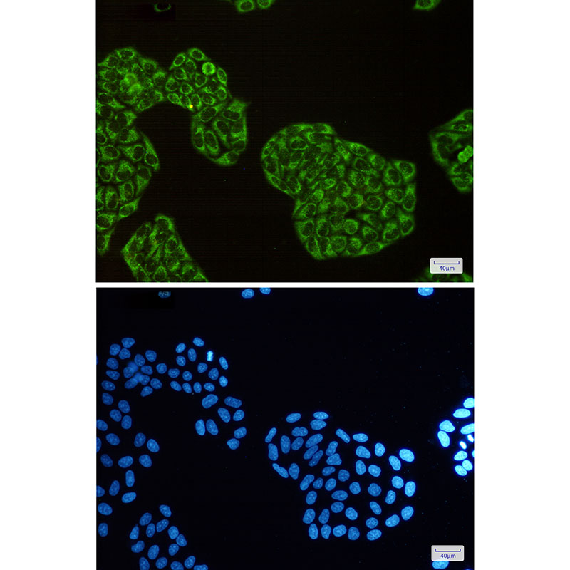 DISC1 Rabbit mAb