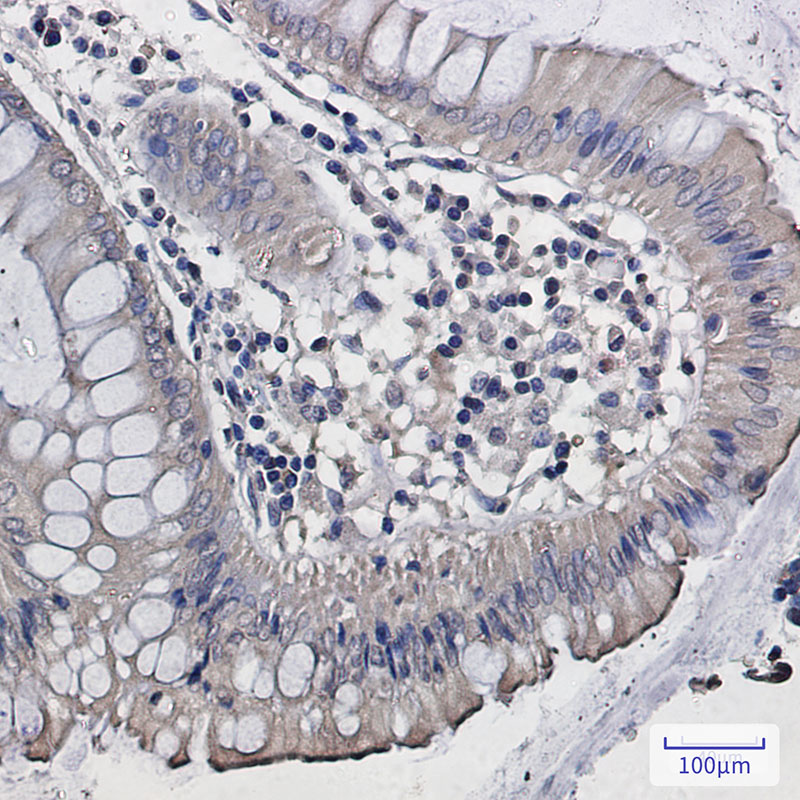 DISC1 Rabbit mAb