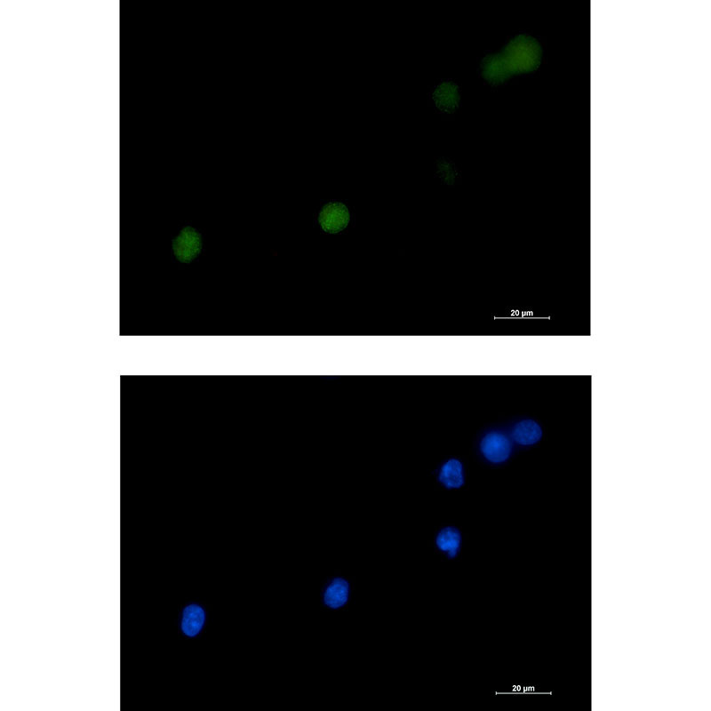 DKC1 Rabbit mAb