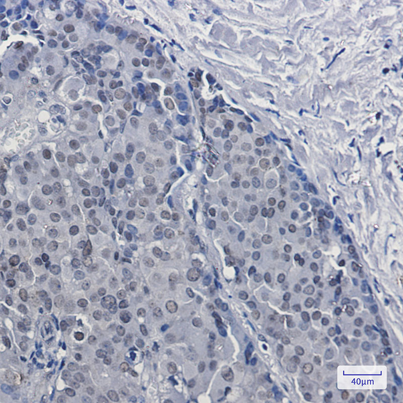 DKC1 Rabbit mAb