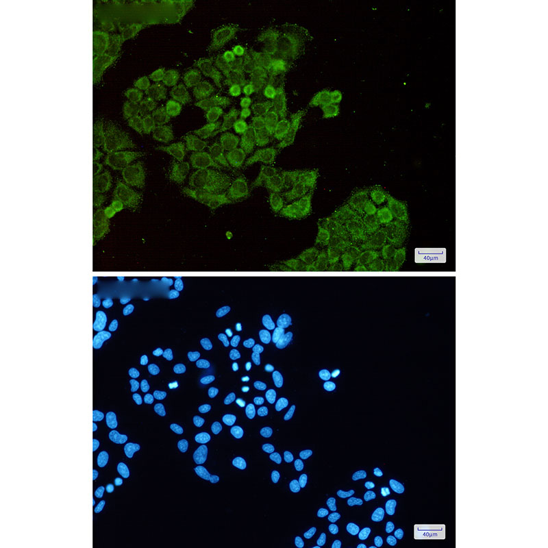 Dnmt1 Rabbit mAb