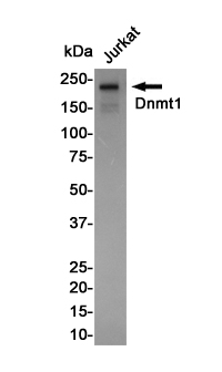 Dnmt1 Rabbit mAb