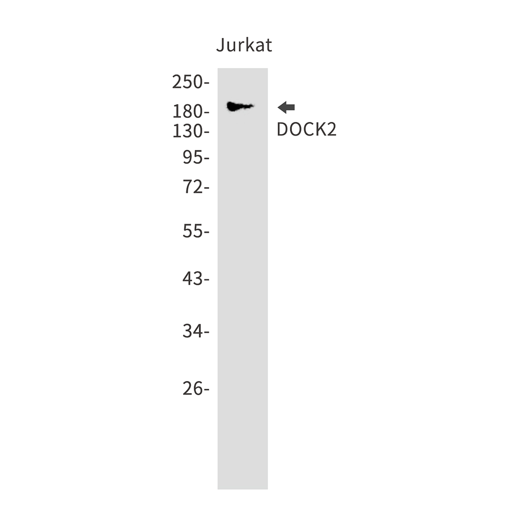 DOCK2 Rabbit mAb