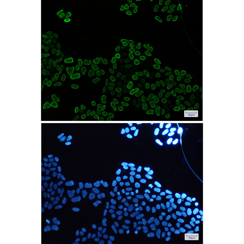 E2F1 Rabbit mAb