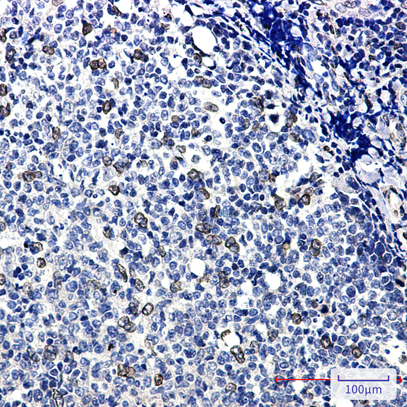 E2F1 Rabbit mAb