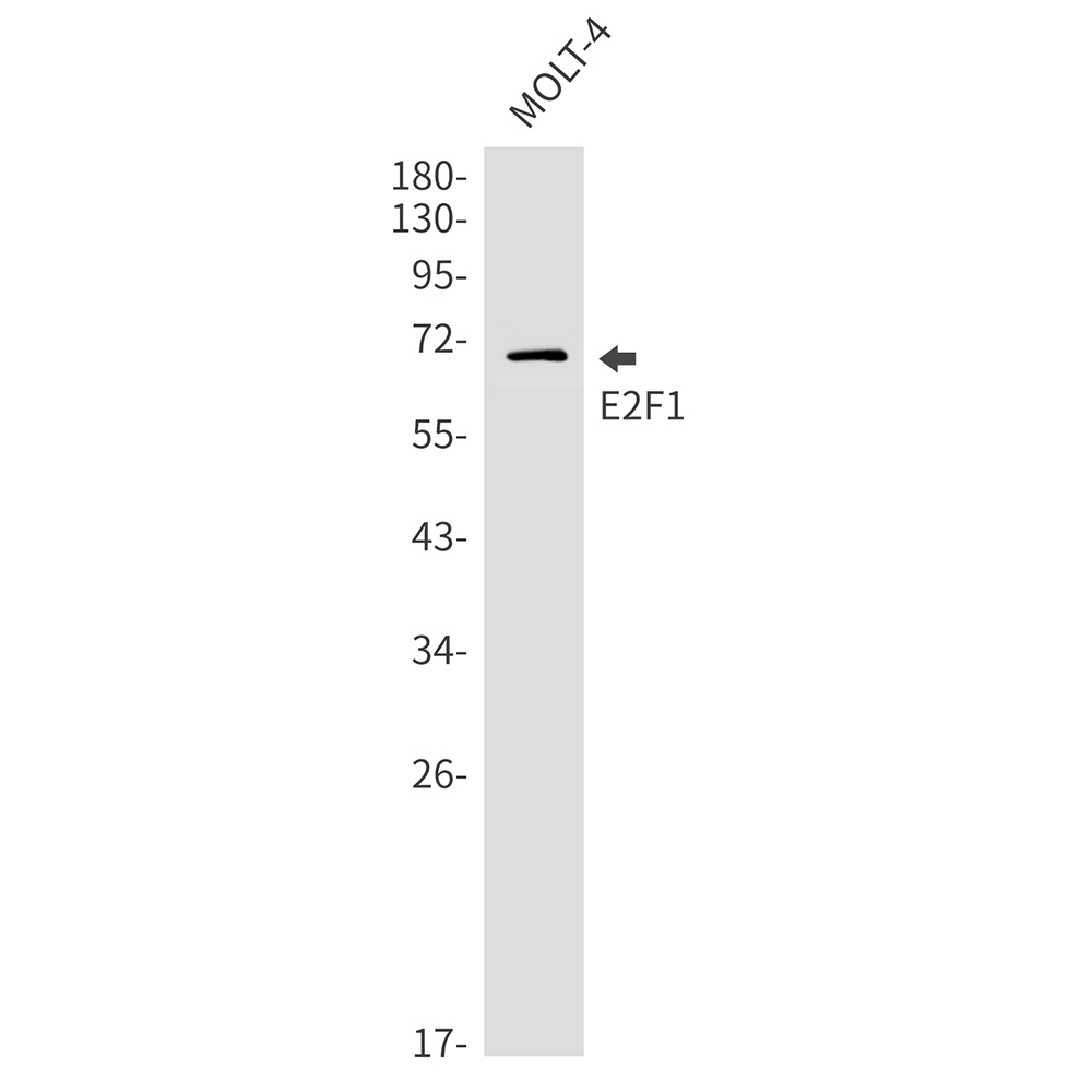 E2F1 Rabbit mAb