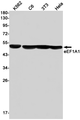 Elongation Factor 1A1 Rabbit mAb