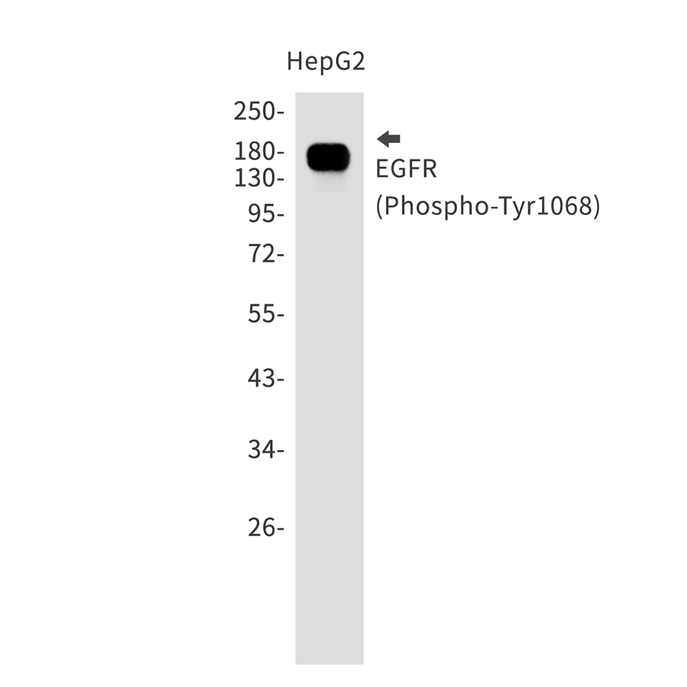 Phospho-EGFR (Tyr1068) Rabbit mAb