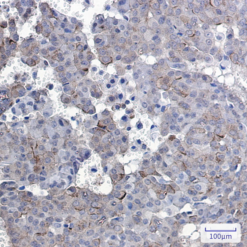 Phospho-EGFR (Tyr1092) Rabbit mAb