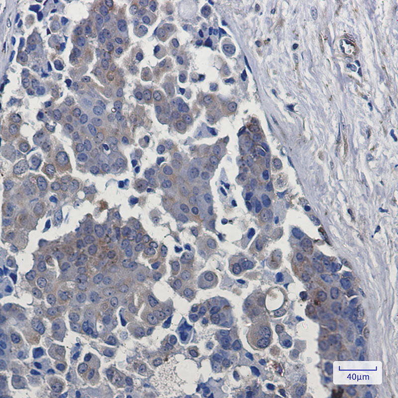 EGFR Rabbit mAb