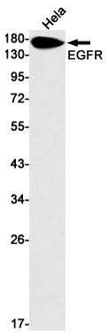 EGFR Rabbit mAb