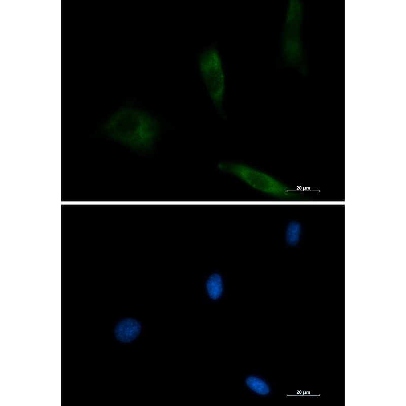 EGFR Rabbit mAb