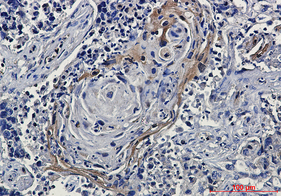 EGFR Rabbit mAb