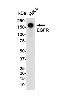 EGFR Rabbit mAb