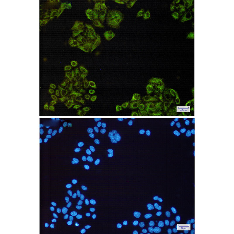 EGFR Rabbit mAb