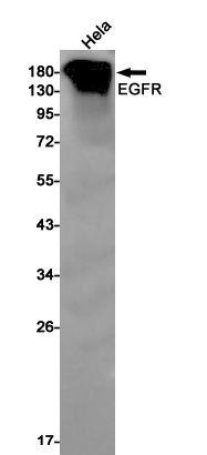 EGFR Rabbit mAb