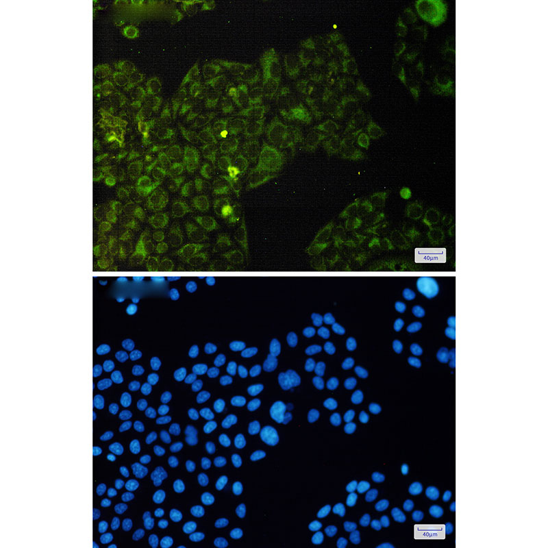 Phospho-eIF4E (Ser209) Rabbit mAb