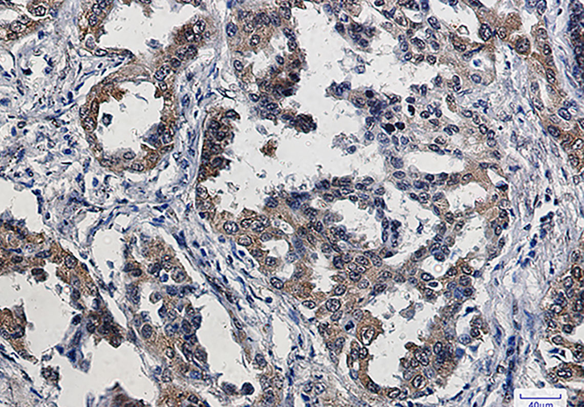 Phospho-eIF4E (Ser209) Rabbit mAb