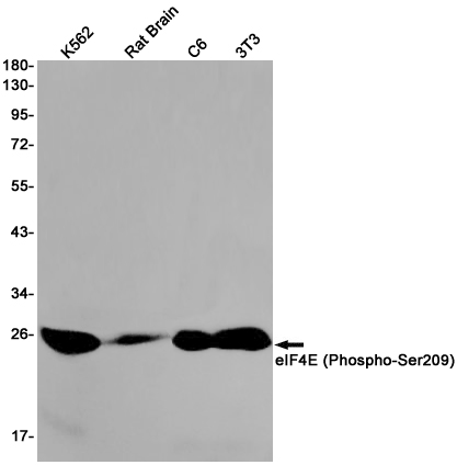 Phospho-eIF4E (Ser209) Rabbit mAb