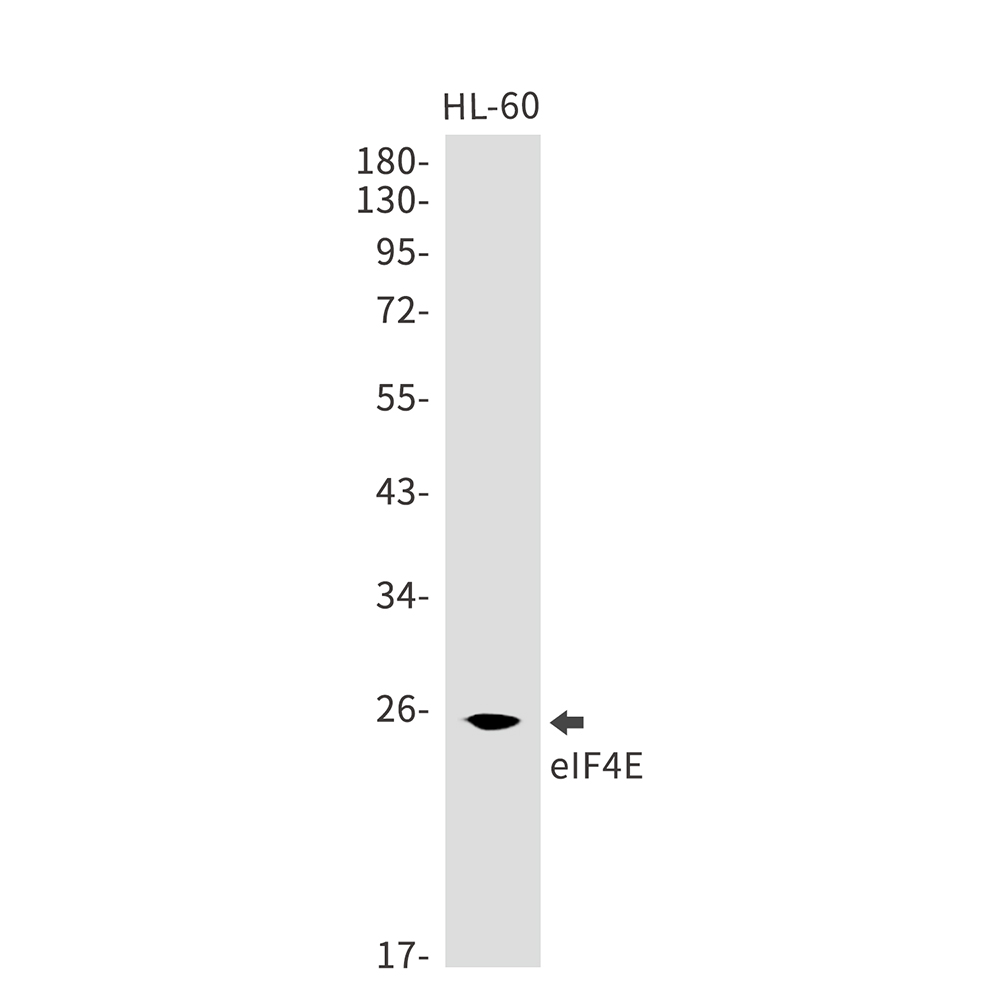 eIF4E Rabbit mAb