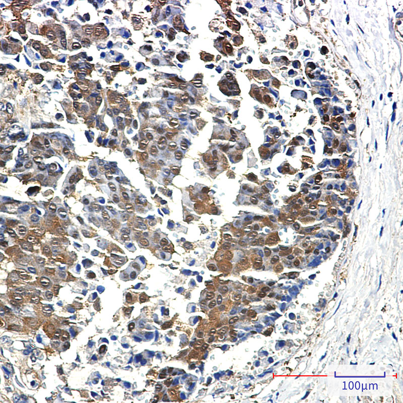 4E BP1 Rabbit mAb