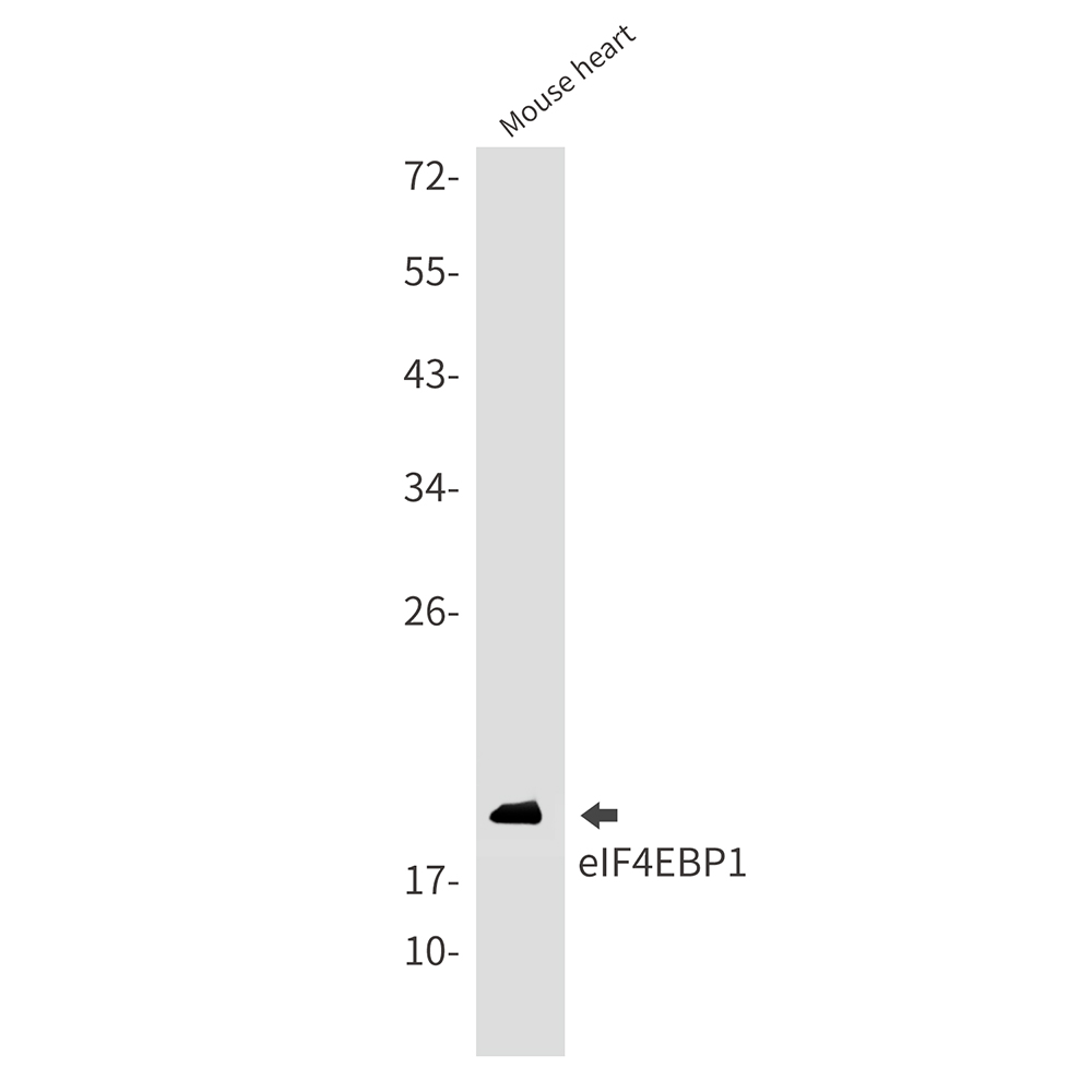 4E BP1 Rabbit mAb