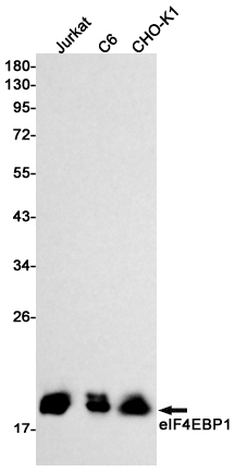 4E BP1 Rabbit mAb