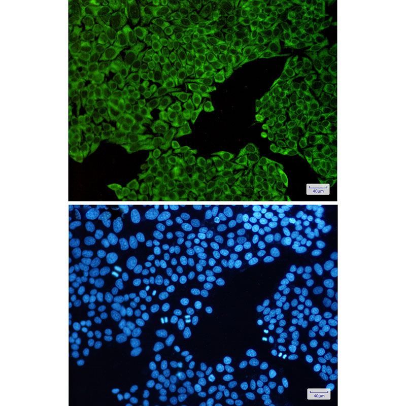 ENO3 Rabbit mAb