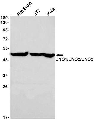 ENO1/2/3 Rabbit mAb