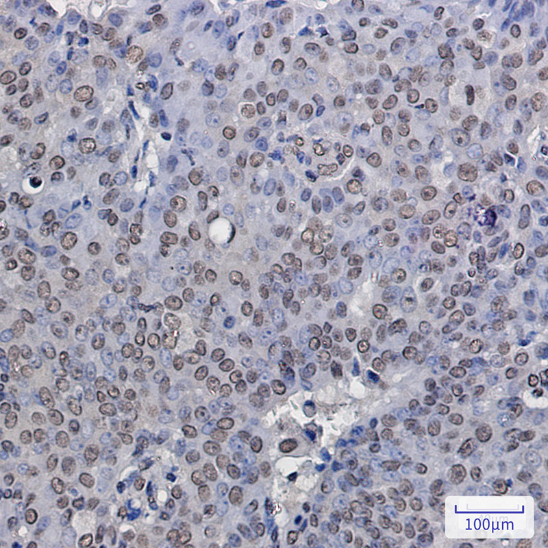 ENT2 Rabbit mAb