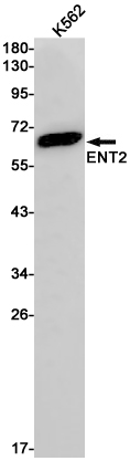 ENT2 Rabbit mAb