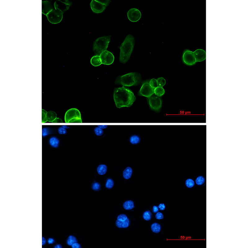 EpCAM Rabbit mAb