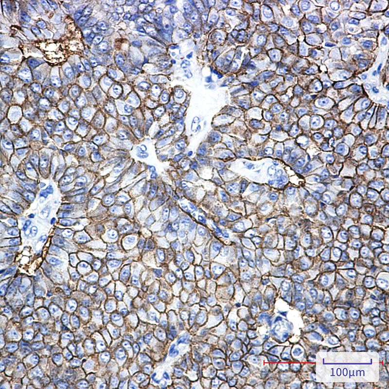 EpCAM Rabbit mAb