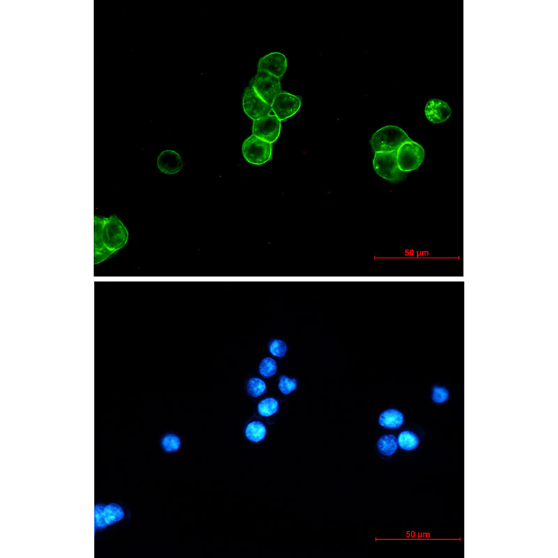 EpCAM Rabbit mAb