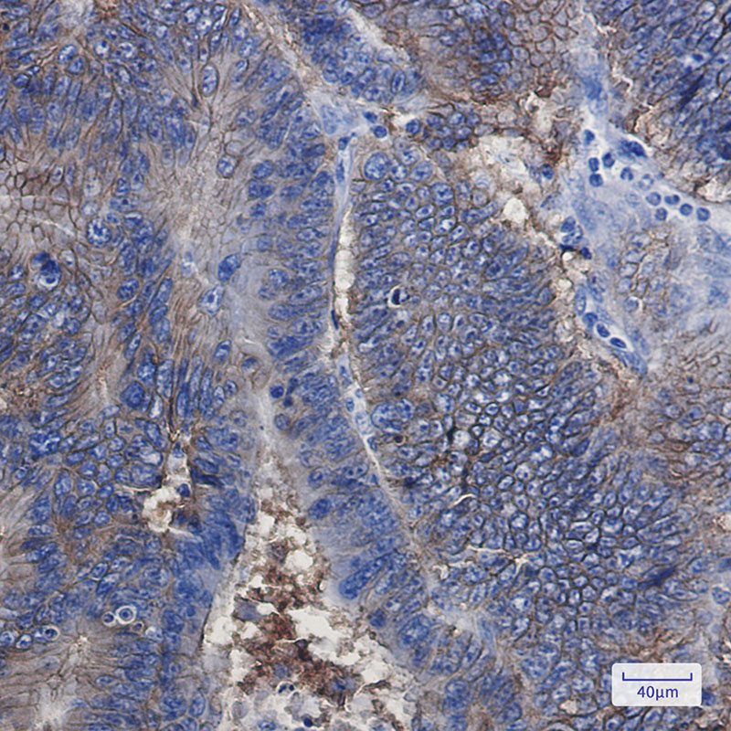 EpCAM Rabbit mAb