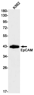 EpCAM Rabbit mAb