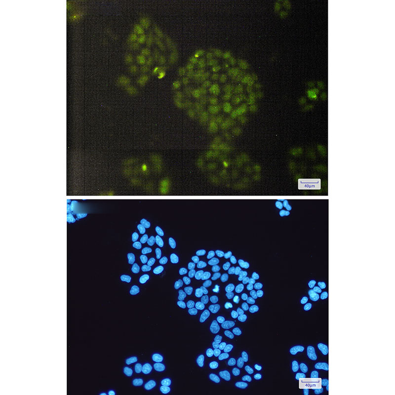 ERCC1 Rabbit mAb