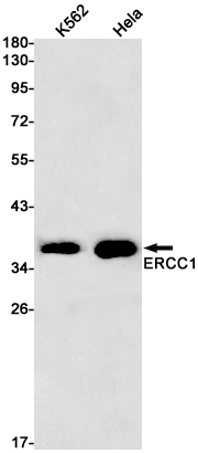 ERCC1 Rabbit mAb