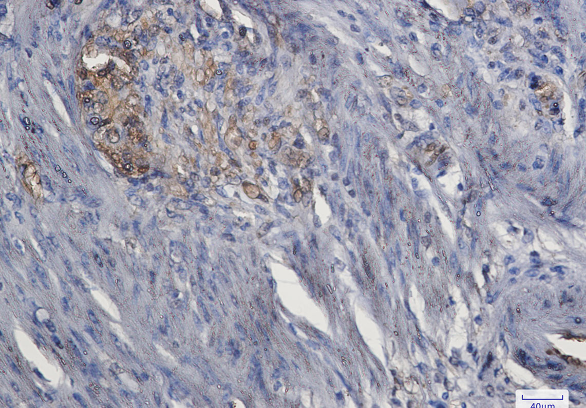 ERK1 Rabbit mAb