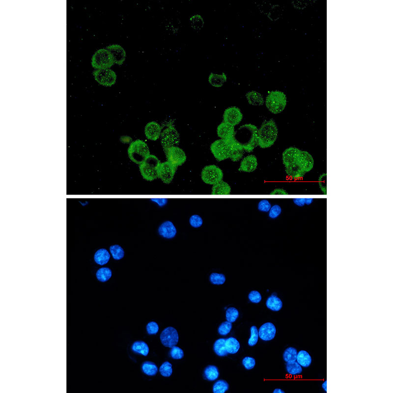 Estrogen Receptor alpha Rabbit mAb