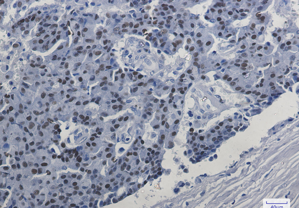 Estrogen Receptor alpha Rabbit mAb