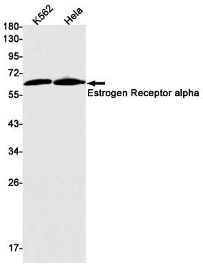 Estrogen Receptor alpha Rabbit mAb