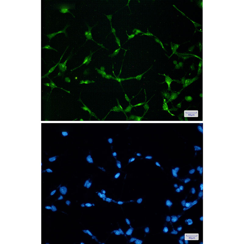 EWSR1 Rabbit mAb