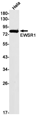 EWSR1 Rabbit mAb