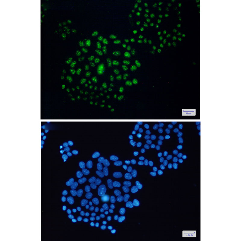 EWSR1 Rabbit mAb