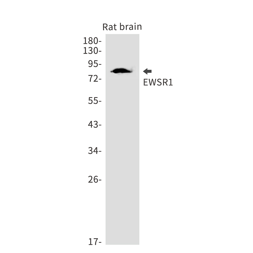 EWSR1 Rabbit mAb